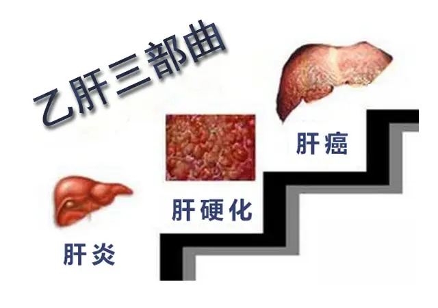 健康人感染乙肝的幾率是多少？